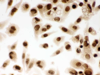 DDB1 Rabbit Polyclonal Antibody