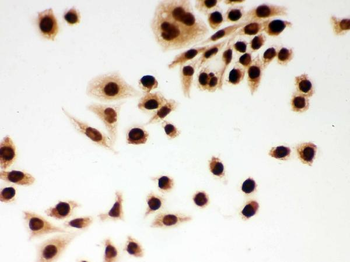 DDB1 Rabbit Polyclonal Antibody