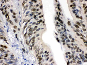 DDB1 Rabbit Polyclonal Antibody
