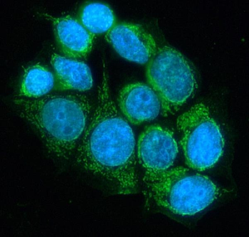 Lipoamide Dehydrogenase/DLD Rabbit Polyclonal Antibody