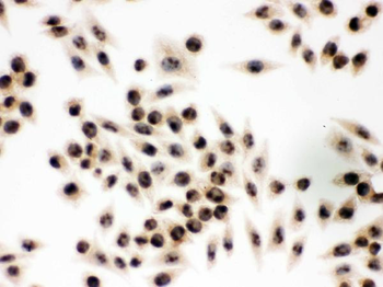 integrin beta 4 binding protein/EIF6 Rabbit Polyclonal Antibody