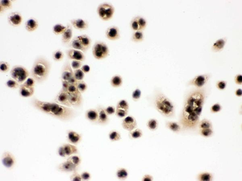 integrin beta 4 binding protein/EIF6 Rabbit Polyclonal Antibody