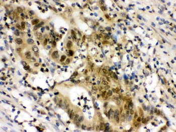 integrin beta 4 binding protein/EIF6 Rabbit Polyclonal Antibody