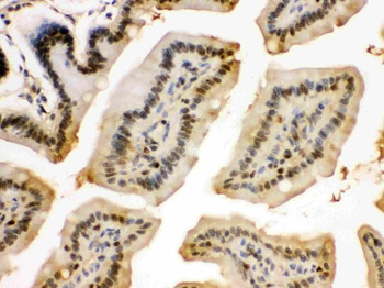 integrin beta 4 binding protein/EIF6 Rabbit Polyclonal Antibody