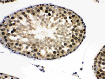 integrin beta 4 binding protein/EIF6 Rabbit Polyclonal Antibody