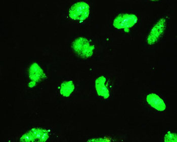 EWSR1 Rabbit Polyclonal Antibody