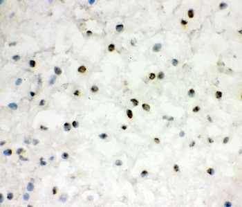 EWSR1 Rabbit Polyclonal Antibody