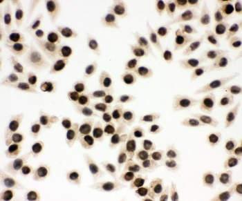 EWSR1 Rabbit Polyclonal Antibody