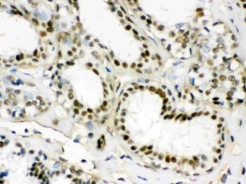 EWSR1 Rabbit Polyclonal Antibody