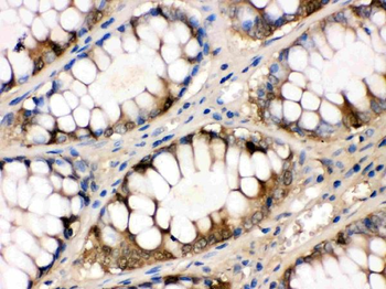 liver FABP/FABP1 Rabbit Polyclonal Antibody