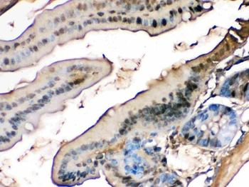 liver FABP/FABP1 Rabbit Polyclonal Antibody