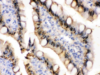 liver FABP/FABP1 Rabbit Polyclonal Antibody