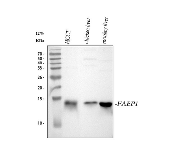 liver FABP/FABP1 Rabbit Polyclonal Antibody