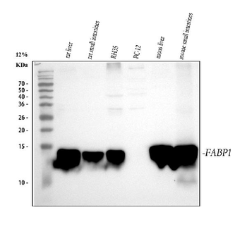 liver FABP/FABP1 Rabbit Polyclonal Antibody