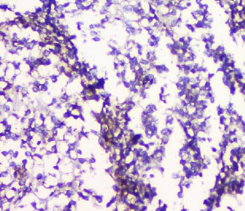 5HT2A Receptor/HTR2A Rabbit Polyclonal Antibody