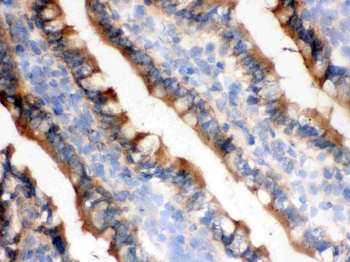 Isocitrate dehydrogenase/IDH1 Rabbit Polyclonal Antibody