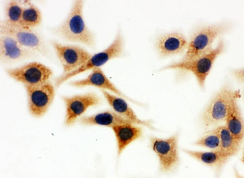 Isocitrate dehydrogenase/IDH1 Rabbit Polyclonal Antibody