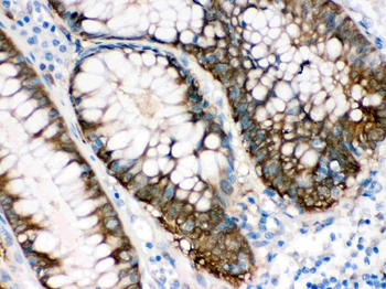 Isocitrate dehydrogenase/IDH1 Rabbit Polyclonal Antibody