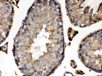 Isocitrate dehydrogenase/IDH1 Rabbit Polyclonal Antibody