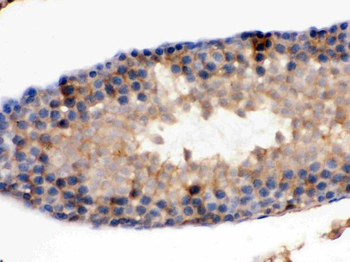 Isocitrate dehydrogenase/IDH1 Rabbit Polyclonal Antibody