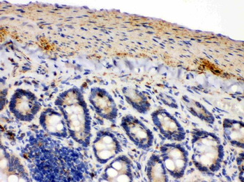 IDH2 Rabbit Polyclonal Antibody