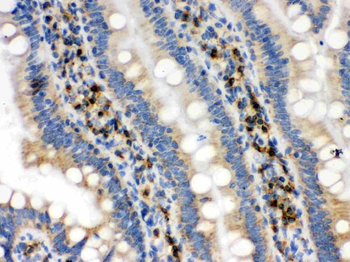 IDH2 Rabbit Polyclonal Antibody