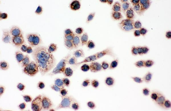 IDH2 Rabbit Polyclonal Antibody