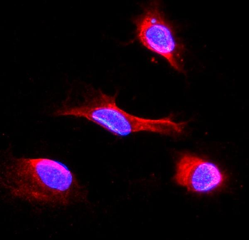 IDH2 Rabbit Polyclonal Antibody