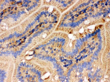 IDH2 Rabbit Polyclonal Antibody