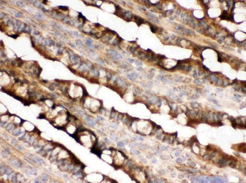 IDH2 Rabbit Polyclonal Antibody