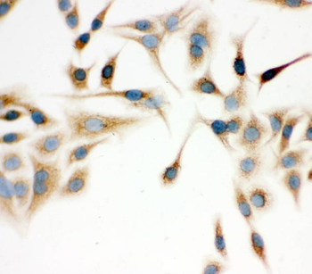 IDH2 Rabbit Polyclonal Antibody