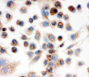 IDH2 Rabbit Polyclonal Antibody