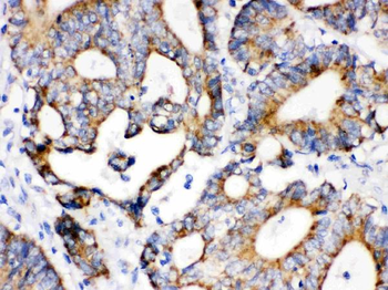 IDH2 Rabbit Polyclonal Antibody