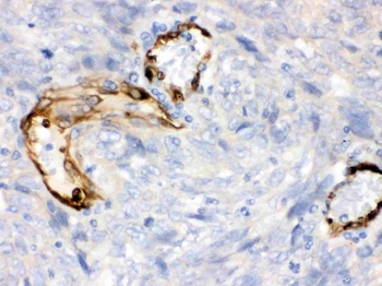 Indoleamine 2, 3-dioxygenase/IDO1 Rabbit Polyclonal Antibody