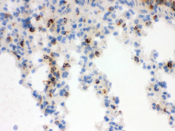 Lipocalin 2/LCN2 Antibody