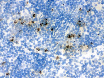 Lipocalin 2/LCN2 Antibody