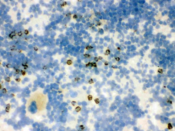 Lipocalin 2/LCN2 Antibody