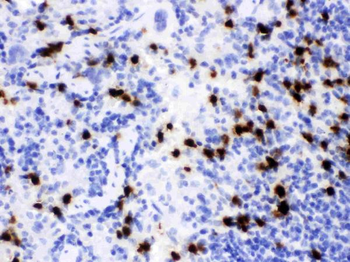 Lipocalin 2/LCN2 Antibody