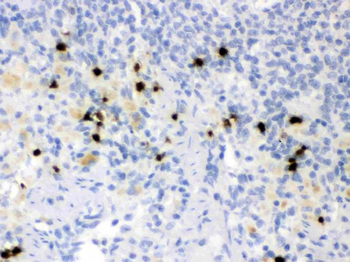 Lipocalin 2/LCN2 Antibody