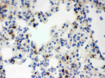 Lipocalin 2/LCN2 Rabbit Polyclonal Antibody