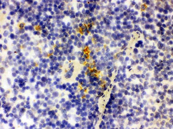 Lipocalin 2/LCN2 Rabbit Polyclonal Antibody