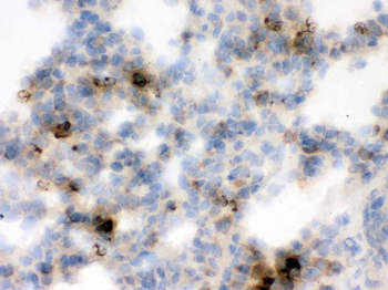 Lipocalin 2/LCN2 Rabbit Polyclonal Antibody