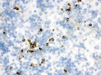 Lipocalin 2/LCN2 Rabbit Polyclonal Antibody