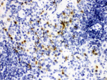 Lipocalin 2/LCN2 Rabbit Polyclonal Antibody
