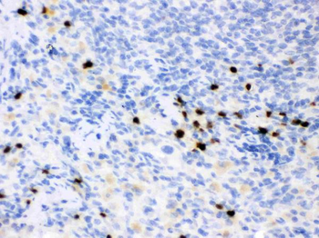 Lipocalin 2/LCN2 Rabbit Polyclonal Antibody