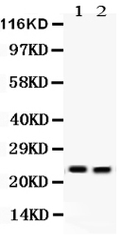 Lipocalin 2/LCN2 Rabbit Polyclonal Antibody