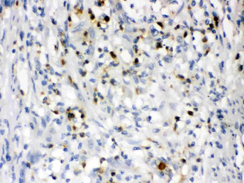 Lipocalin 2/LCN2 Rabbit Polyclonal Antibody