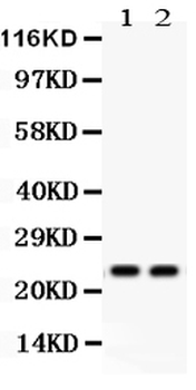 Lipocalin 2/LCN2 Rabbit Polyclonal Antibody