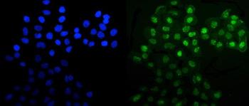 MNAT1 Rabbit Polyclonal Antibody