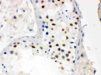MNAT1 Rabbit Polyclonal Antibody